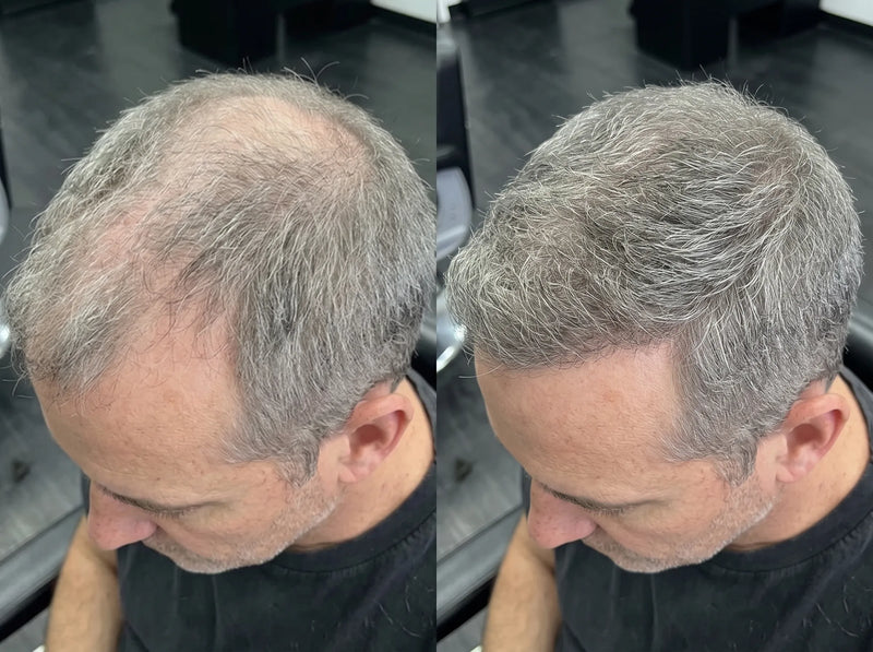 Javier M. Barcelona before and after results