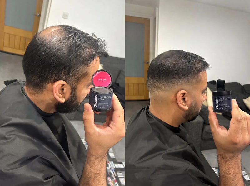 Diego G. Sevilla before and after results
